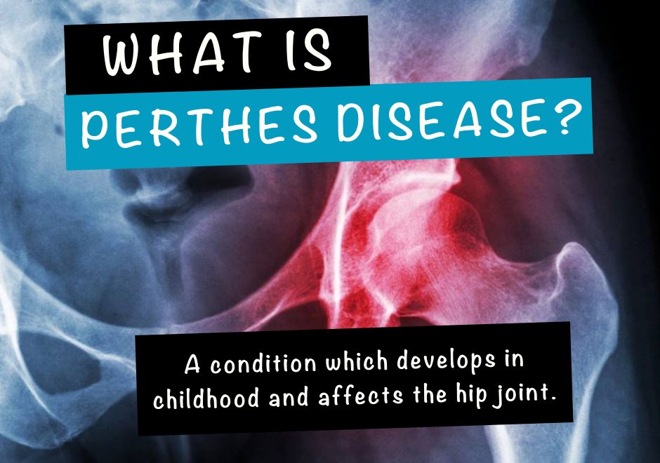 Understanding a painful, littleknown condition in children Perthes